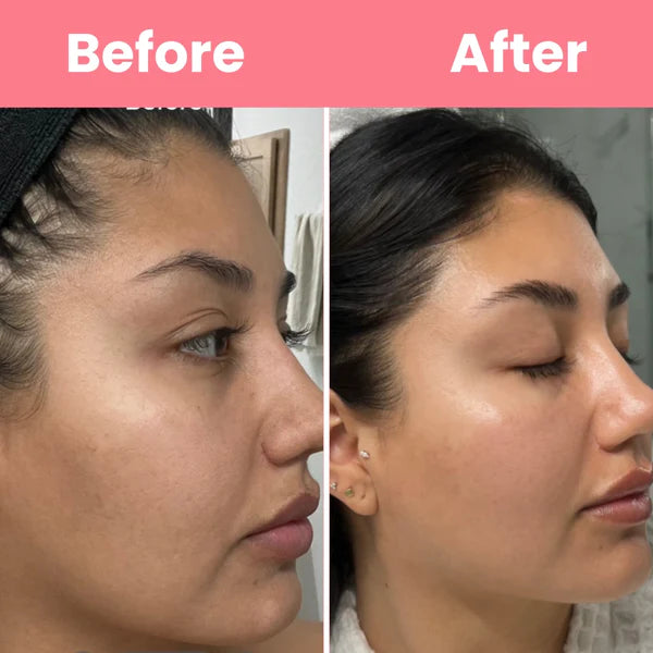 🌙✨ Collagen Night Mask – Wake Up to Glass Skin! 💖 [Only ₹499 | Buy 1 Get 1 ₹699]