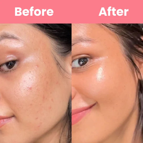 🌙✨ Collagen Night Mask – Wake Up to Glass Skin! 💖 [Only ₹499 | Buy 1 Get 1 ₹699]